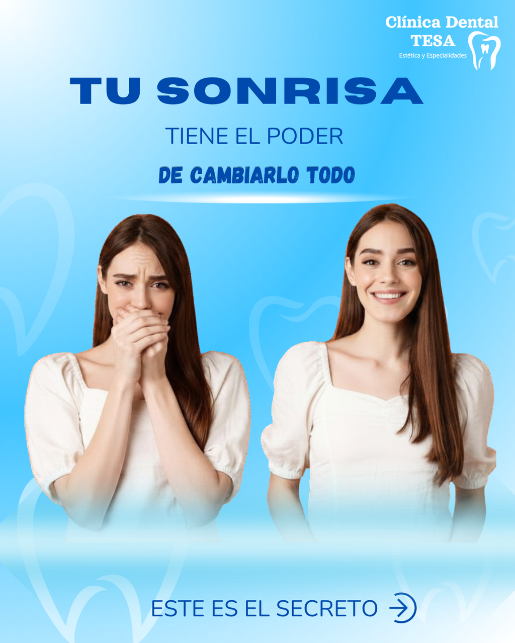 blanqueamiento